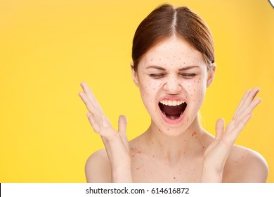 The Woman's Face In The Rash, Face In The Pimples, The Woman Screams In Horror, Her Face Is In A Red Dot