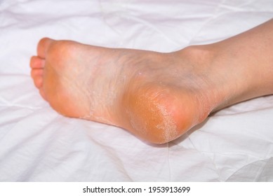 Deep wrinkled soles