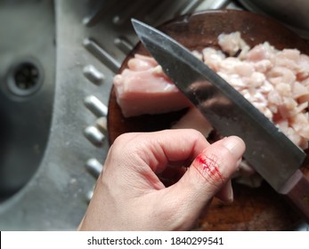 Woman's Finger Cut While Cooking A Lunch, Bleeding, Cooking Injury