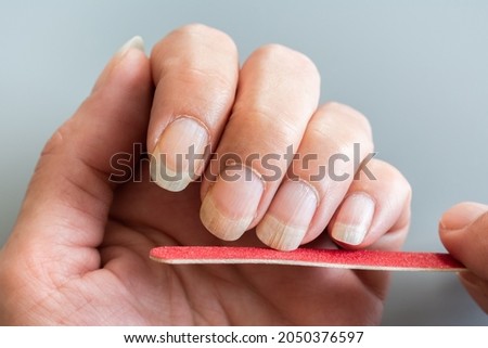 Woman's hand filing her fingernails, close-up.
Striated, damaged, dried out nails