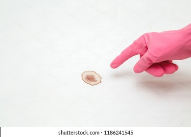 Woman's Hand In Rubber Protective Glove Pointing To Mattress Blood Stain After Night Menstruation. Fresh Or Old Stains Cleaning From White Sheet Of Bed. 