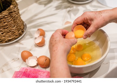 Woman's Hands Cracking Eggs In A Bowl