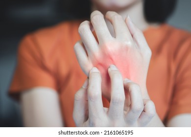 A Woman's Hands Have Red Rashes, Causing Itching Due To Insect Bites Or Allergies To Certain Substances.