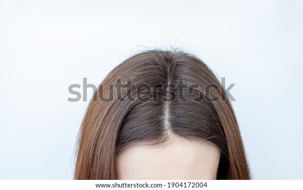 A\
woman\'s head with a parting of gray hair that has grown roots due\
to quarantine. Brown hair on a woman\'s head\
close-up.