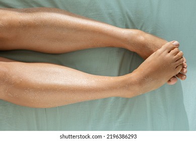 Woman's Legs With Dry Skin That Is Ashamed. Feet That Tighten In A Position Of Embarrassment.