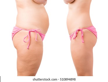 Woman's silhouette before and after weight loss