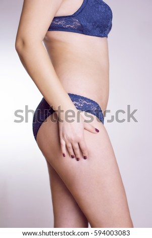 Women with cellulite problem