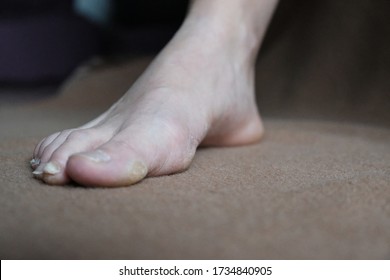 153 Toe nail discoloration Images, Stock Photos & Vectors | Shutterstock