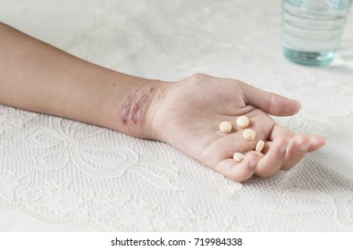 Women Hand Holding White Pill  With Poison Ivy Rash On Arm On White Background