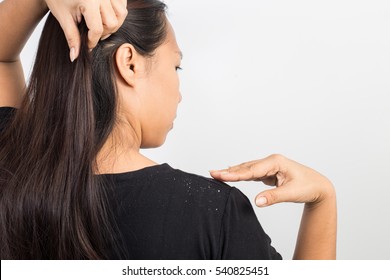 Women Having Dandruff In The Hair And Shoulder