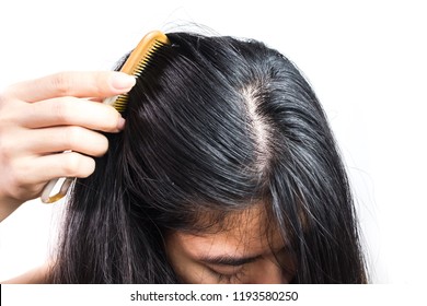 Dandruff Scalp Stock Photos Images Photography Shutterstock