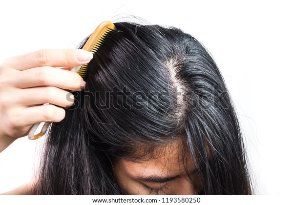 汚れの問題が原因で女性が頭を下げる 皮膚疾患や脂漏性皮膚炎が原因で起こる 白いうろこ状で痒い 製品のコンセプトは頭皮ケアとヘアケアです の写真素材 今すぐ編集