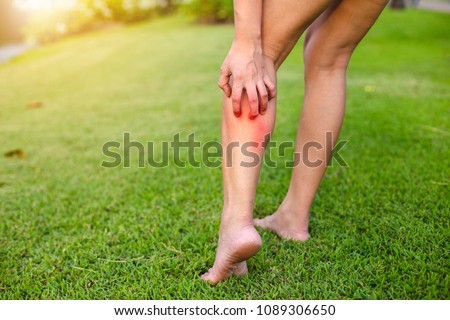 Women with his feet, itching on the lawn caused by insect bites and stings/health and medical view and devising concepts.
