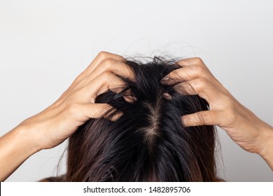 Women Itching Scalp Damaged Hair, Haircare Concept.