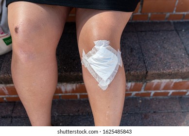 Women Scrape Knee And Showing Wound Bandage