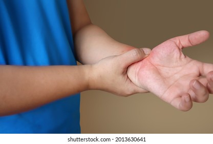 Women Show Hands Pain, Numbness, Tingling (pins And Needles) Muscle Weakness. Signs Of Neurological Disorders, Stroke, Paresthesia, Diabetes, Vaccine Side Effect Disease, Guillain Barre Syndrome, Etc