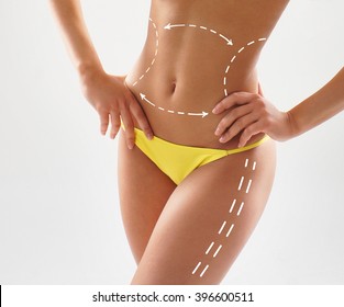 Women slim body in swimwear having arrows along her stomach and legs. Fat lose, liposuction and cellulite removal concept.