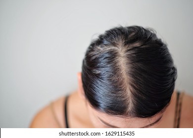 1000 Old Women Thin Hair Stock Images Photos Vectors