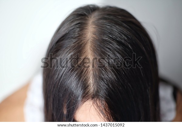 Women Thin Hair Caused By Hair Stock Photo Edit Now 1437015092