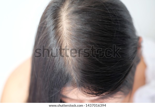 Women Thin Hair Caused By Hair Stock Photo Edit Now 1437016394