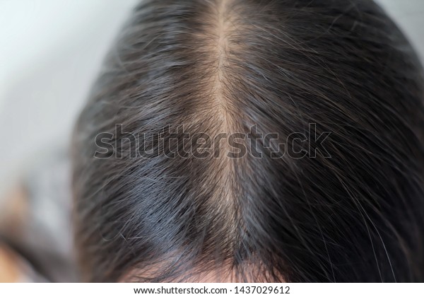 Women Thin Hair Caused By Hair Royalty Free Stock Image
