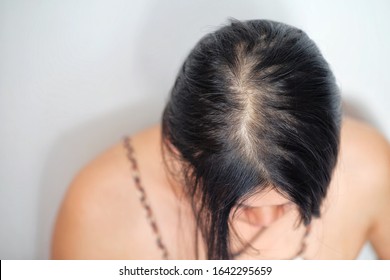 1000 Old Women Thin Hair Stock Images Photos Vectors