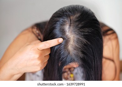 1000 Old Women Thin Hair Stock Images Photos Vectors