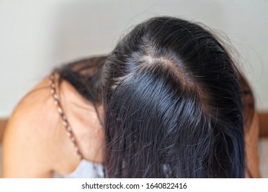 Bald Man Woman Worry About His Stock Photo 1937584963 | Shutterstock