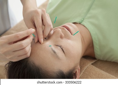 Women undergoing acupuncture to face for health