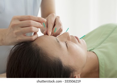 Women undergoing acupuncture to face in the salon for health