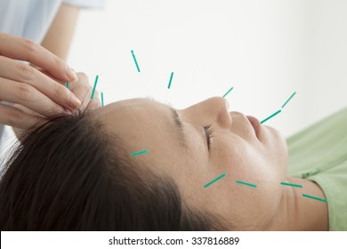 Women who acupuncture to face in the salon