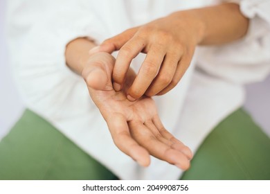 Women Who Have Itching On Their Hands As A Result Of Chemical Exposure. Or The Use Of Products That Contain An Excessive Amount Of Chemicals.