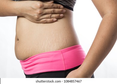 Women who wear exercise clothes. Show off the belly after birth. Stretch Marks on white background