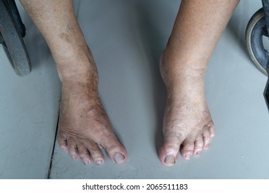 Chubby ebony feet