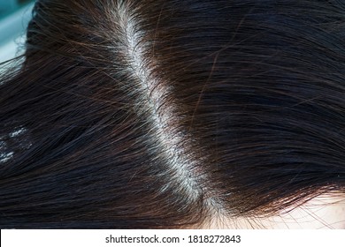 Womens Head With Gray Hair, Close-up View Of Regrown Roots