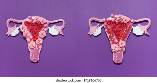 The Women's Reproductive System. The Concept Of Endometriosis Of The Uterus. Beautiful Art Concept Of Gynecological Diseases Made Of Paper. Paper Flowers. 