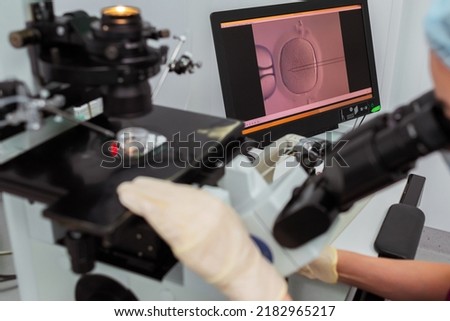 work with the egg in the center of reproductive medicine. artificial fertilization of the egg in the medical office. work with a female egg using a monitor. display of medical data on the monitor