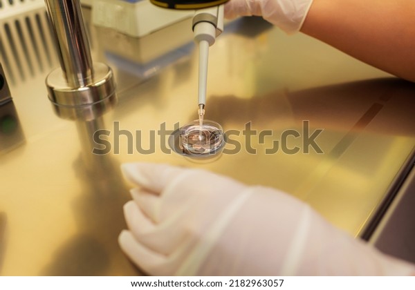 work with the egg in the\
center of reproductive medicine. girl\'s hands work with human dna.\
artificial fertilization of an egg in a medical office using a\
pipette