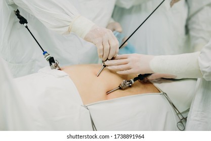 The Work Of Surgeons Using Endo Video Of Surgical Instruments. Laparoscopy. Close-up. Abdominal Surgery Of A Fat Or Pregnant Patient. Endoscopy. Operating Room Surgical Hospital.