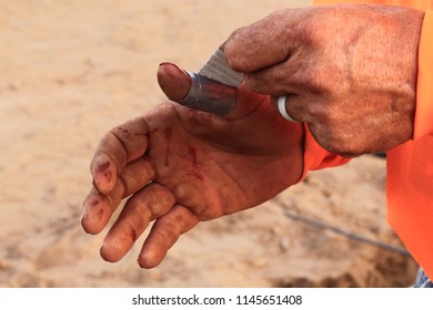 Workers Hands Taping Up A Minor Injury With Industrial Tape