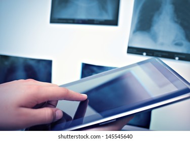 Working With Digital Tablet In Radiology