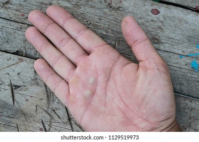 The Working Hands, Corns