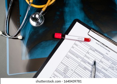 Workplace Of A Doctor. An In Vitro Blood Test Is On An X-ray Photograph Of A Patient With Pneumonia. Top View. Medical Concept.