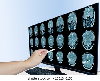 World Stroke Day, Close Up Hand Doctor Point CT Scan Brain A Man Suffering From Pulsating Pain Of A Headache. People Medical Healthcare And Technology Concept