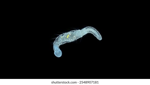 Worm Aeolosoma sp. under a microscope, Aeolosomatidae family. They live on bottom or bottom sediments, feed on detritus, algae, microorganisms by suction like a vacuum cleaner.