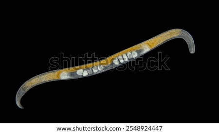 Worm Nematoda under the microscope, Phylum Protostomia, free-living nematodes inhabit soil, freshwater and sea. Black Sea