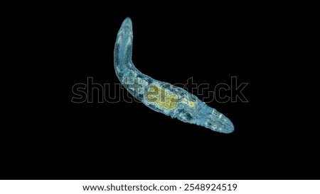 Worm Oligochaeta under the microscope. Feeds on algae, microorganisms and dead organic matter. Species not defined. Volga River