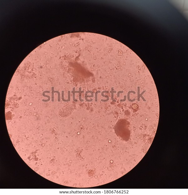 Worms Egg Called Hookworm Egg Taken Stock Photo 1806766252 Shutterstock