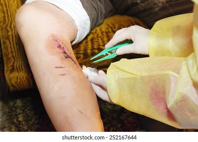 Wound Care By A Nurse At Home