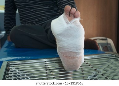 Wound Of Diabetic Foot With Gauze Bandage